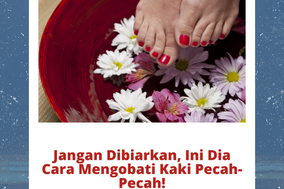 Jangan Dibiarkan, Ini Dia Cara Mengobati Kaki Pecah-Pecah!